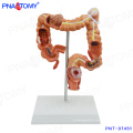 PNT-07451 Modelo intestinal humano Disease Large Intestines model for education